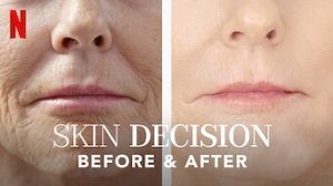 Skin Decision: Before and After 1. Sezon 8. Bölüm izle